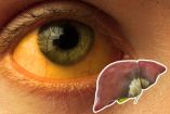 Cuáles son los tipos de hepatitis síntomas y diferencias radio