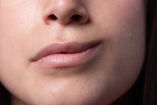 Pasos para identificar parálisis facial