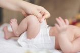Dermatitis del pañal ¿Cómo aliviarla?