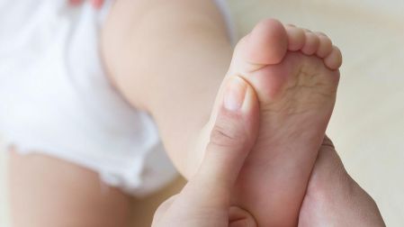 ¿Qué es el pie equino varo, causas y tratamiento?