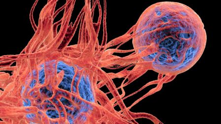 Tipos de cáncer menos mortales cuáles tienen mayor supervivencia y por qué