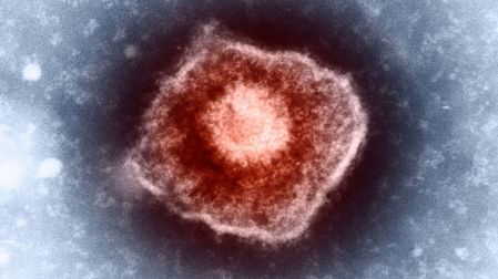 Herpes zóster (culebrilla): qué es y síntomas