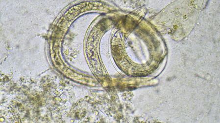 Qué es la cyclospora y cómo actúa en el cuerpo humano