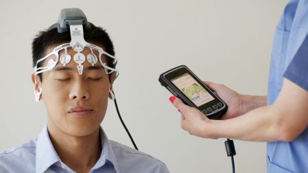Qué es la epilepsia