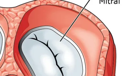 Válvula mitral