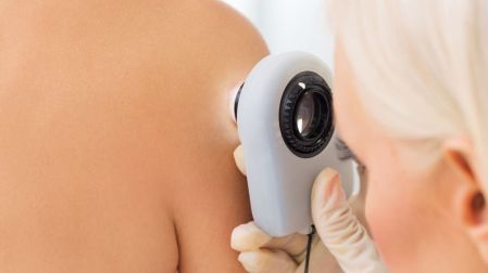 ¿Hay vacuna contra el cáncer de piel Esto sabemos del desarrollo de Moderna y Merck