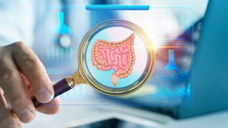 Cáncer de colon en jóvenes