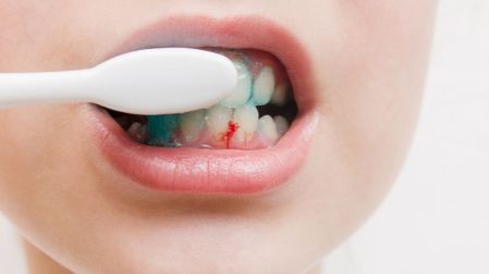 Hemofilia en niños: síntomas, diagnóstico y cómo ha cambiado su tratamiento
