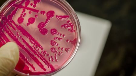 ¿Qué es la salmonella y cuáles son sus síntomas?