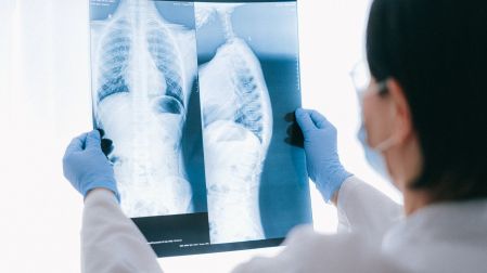Un médico revisa una radiografía de pulmones