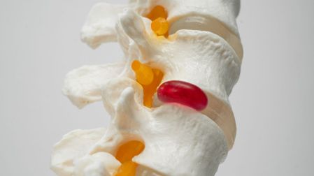Enfermedades de la columna vertebral: principales padecimientos y sus síntomas de alerta