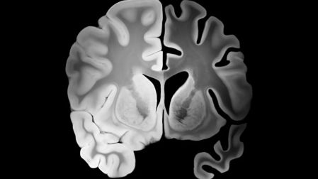 Cuáles son los hábitos que envejecen el cerebro según la ciencia