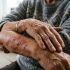 Herpes zóster (culebrilla): qué es y síntomas