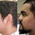 Ángel Abraham recuperó la respiración, masticación y su calidad de vida mediante una reconstrucción facial integral realizada por especialistas del Seguro Social en Nuevo León.