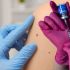 ¿Hay vacuna contra el cáncer de piel Esto sabemos del desarrollo de Moderna y Merck