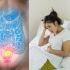 Cáncer de colon en jóvenes