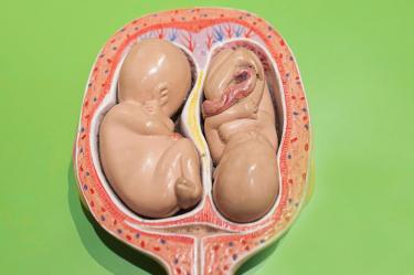 ¿Un embarazo gemelar siempre termina en cesárea? Mitos y realidades