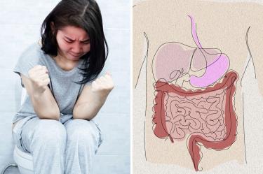 ¿El estreñimiento crónico puede causar que el intestino se paralice?