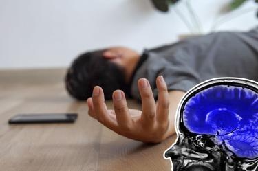 Qué es la epilepsia