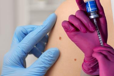 ¿Hay vacuna contra el cáncer de piel Esto sabemos del desarrollo de Moderna y Merck