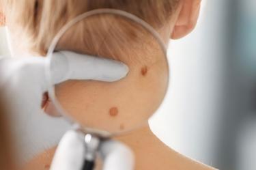 Visitar al dermatólogo no es sólo una cuestión estética.