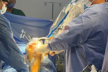 El robot de última generación ROSA optimiza la precisión en cirugías de artroplastia total de rodilla