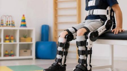 APAC reporta 400 mil casos de discapacidad motora infantil en el país