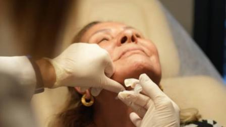 Dra. Marisol Góngora advierte que fumar eleva 80% el riesgo de necrosis en un facelift