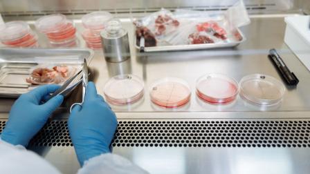 Brote de salmonela en Hospital General de México afecta a 135 residentes: David Kerschenovitch